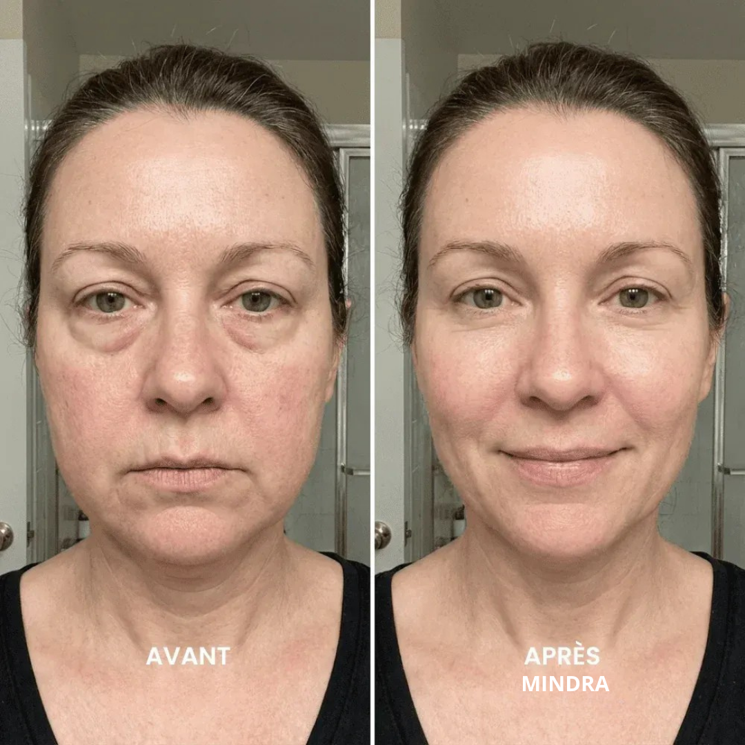 MinSculpt - Brosse Drainage Lymphatique Visage